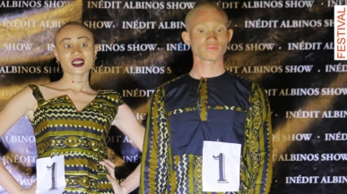 Observatory for the Rights of People with Albinism in Mali