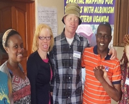 My life as a person with albinism in Uganda – two women share their stories!